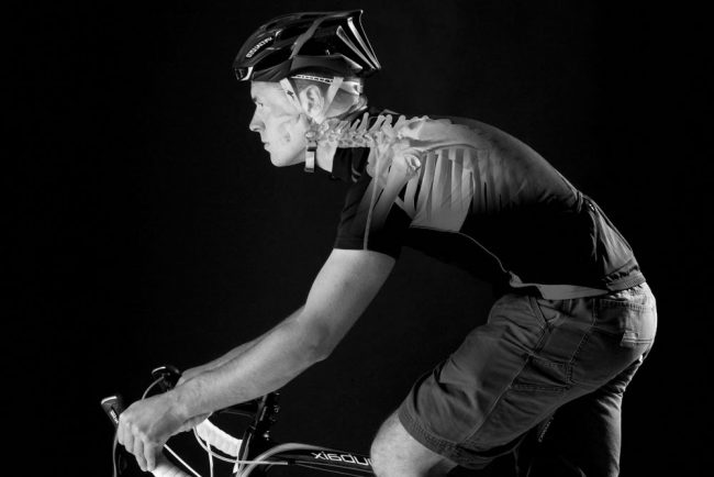 Cervical neck pain in cycling